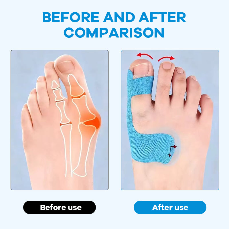 🦶Vorgeschnittenes Kinesiologie-Tape für Hallux valgu